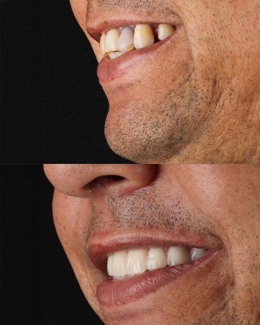 caso6